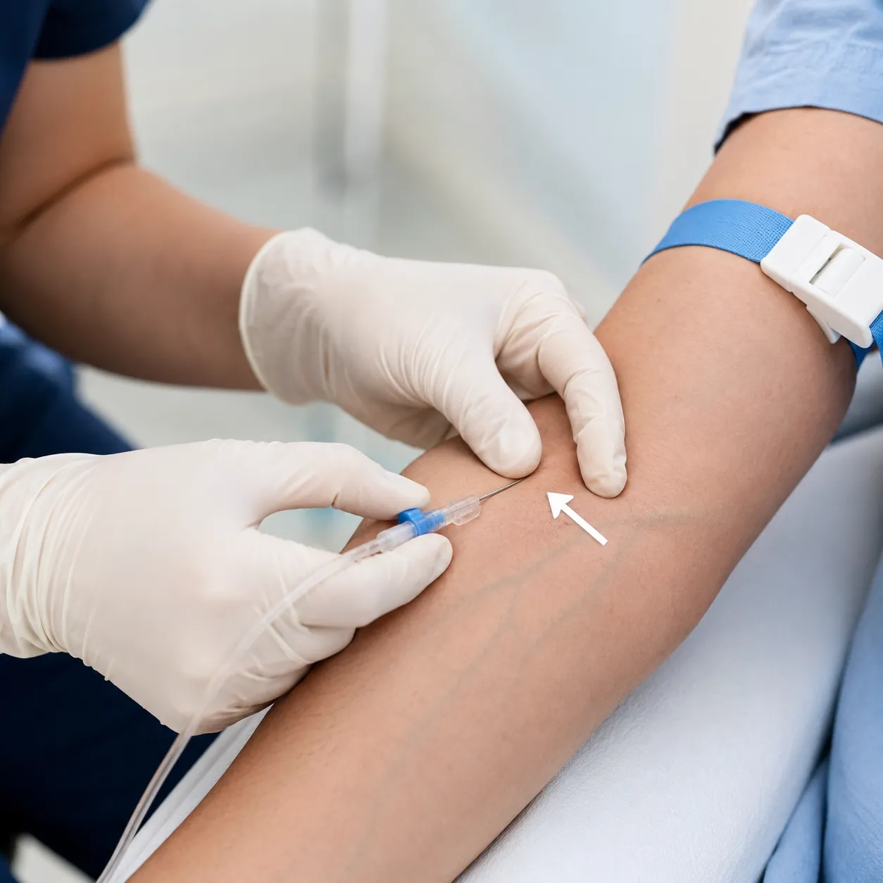 start an IV