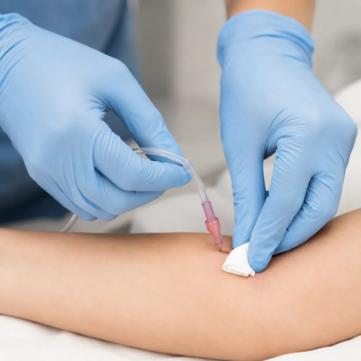 remove an IV