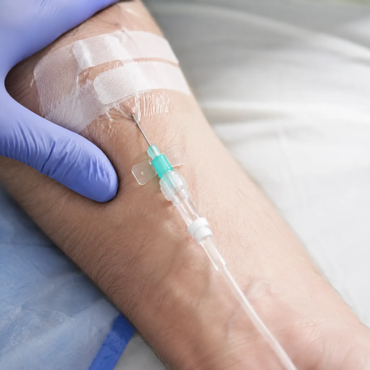 intravenous
