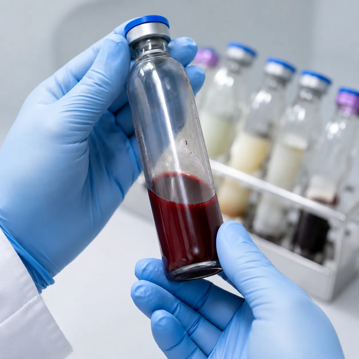 blood culture