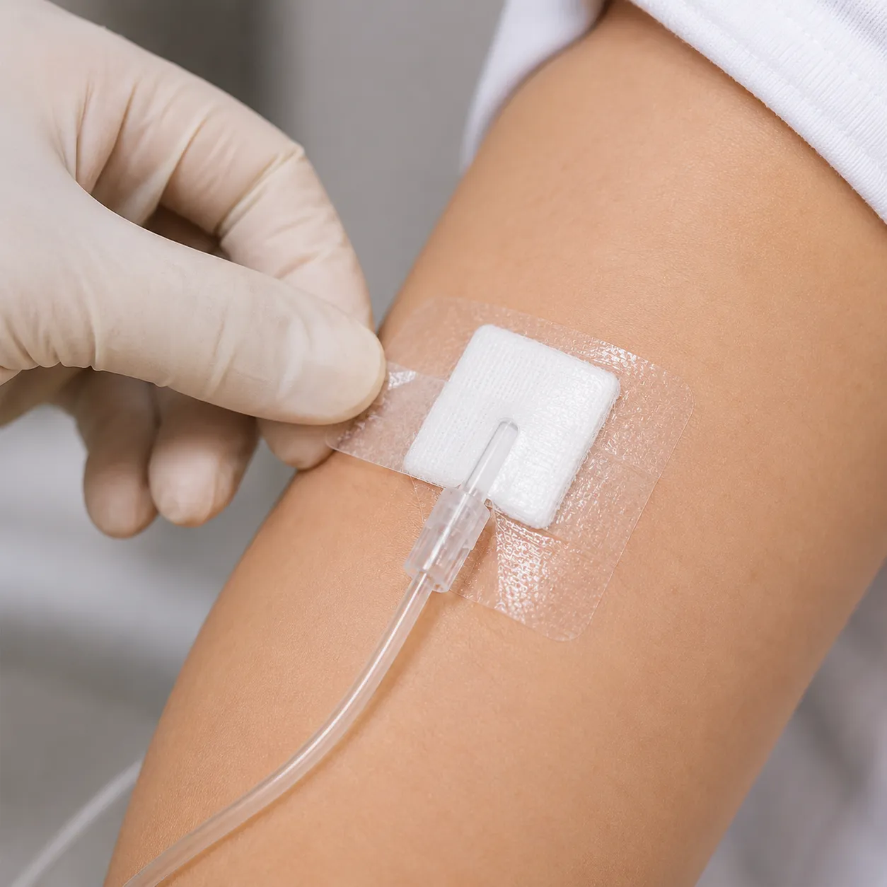 medical adhesive
