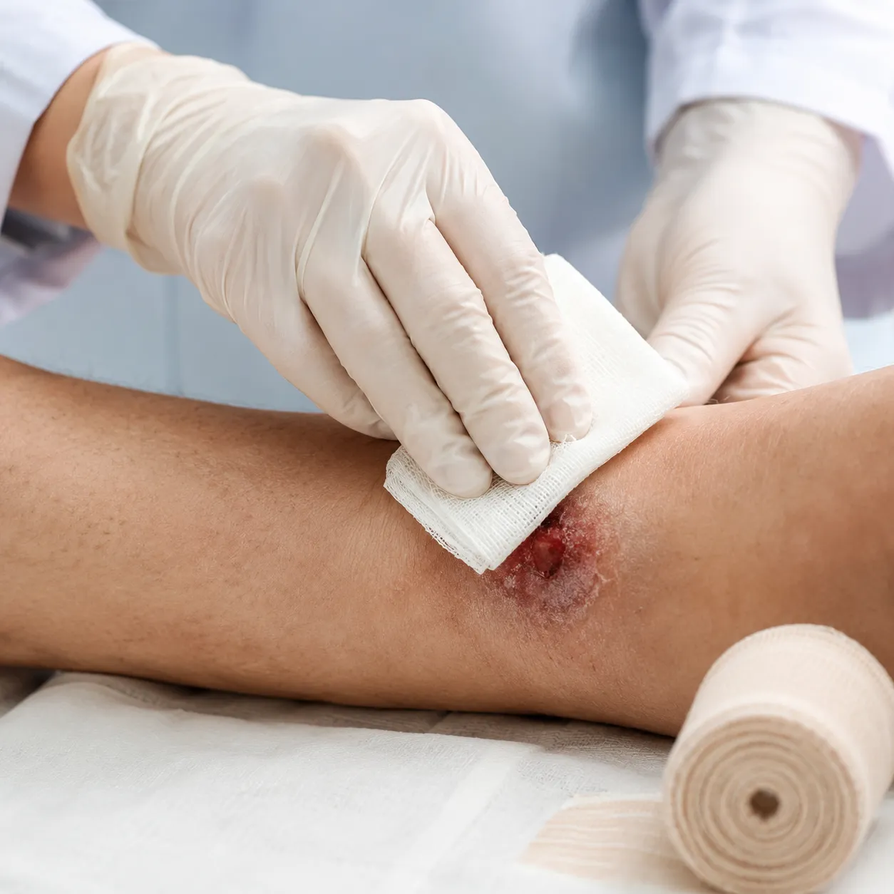 wound care