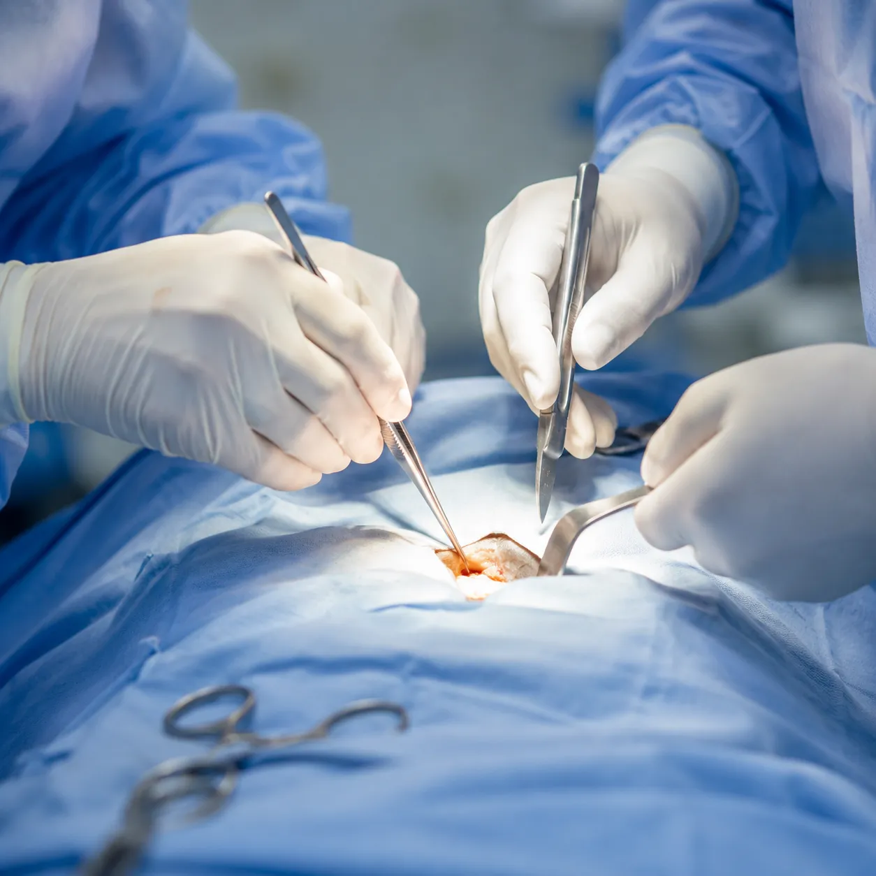 surgery