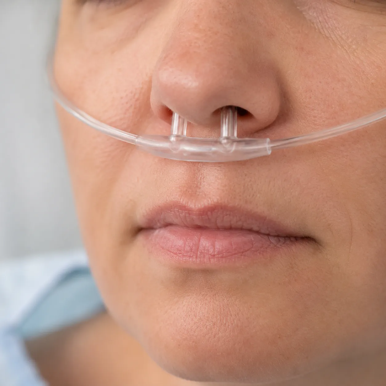 nasal cannula