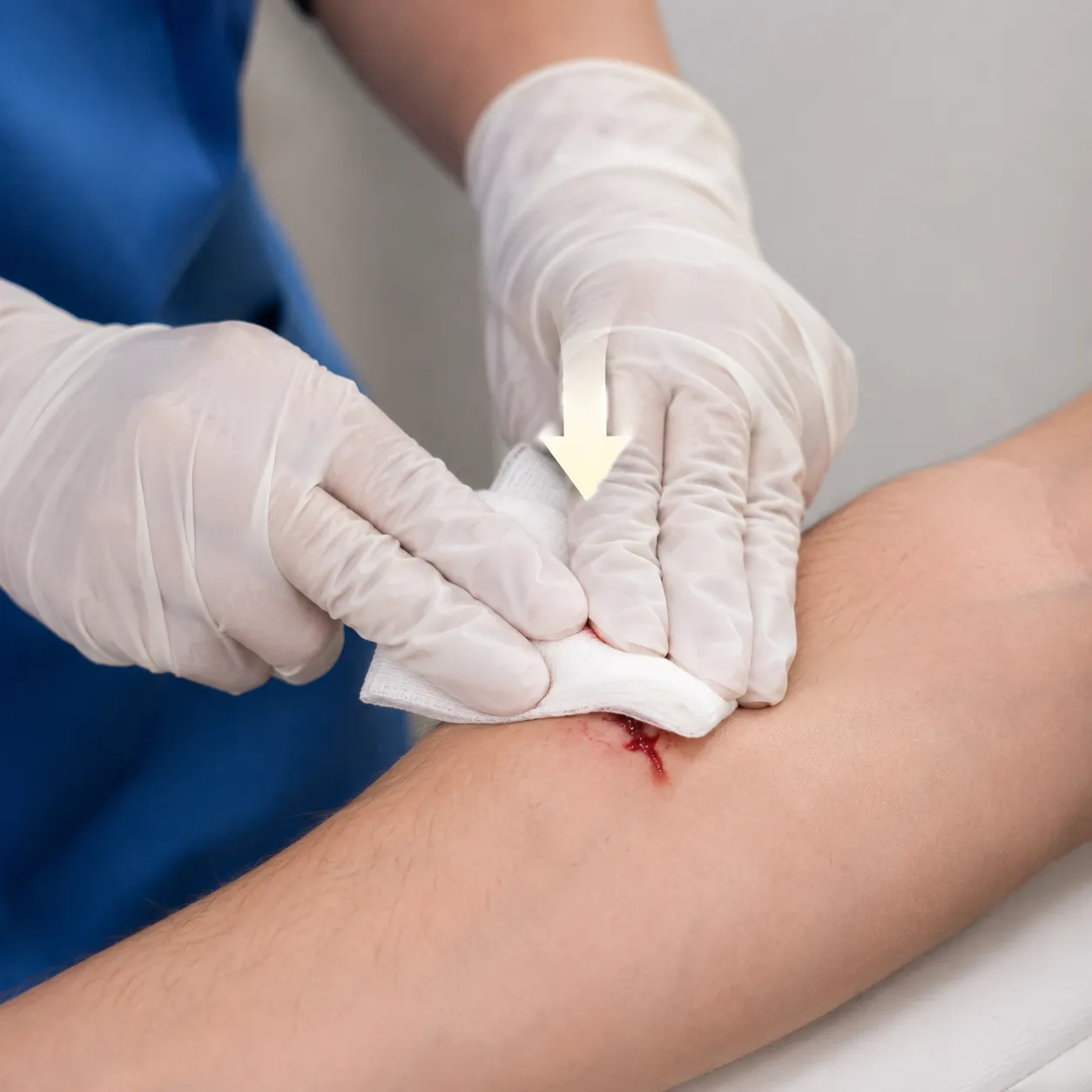 stop bleeding