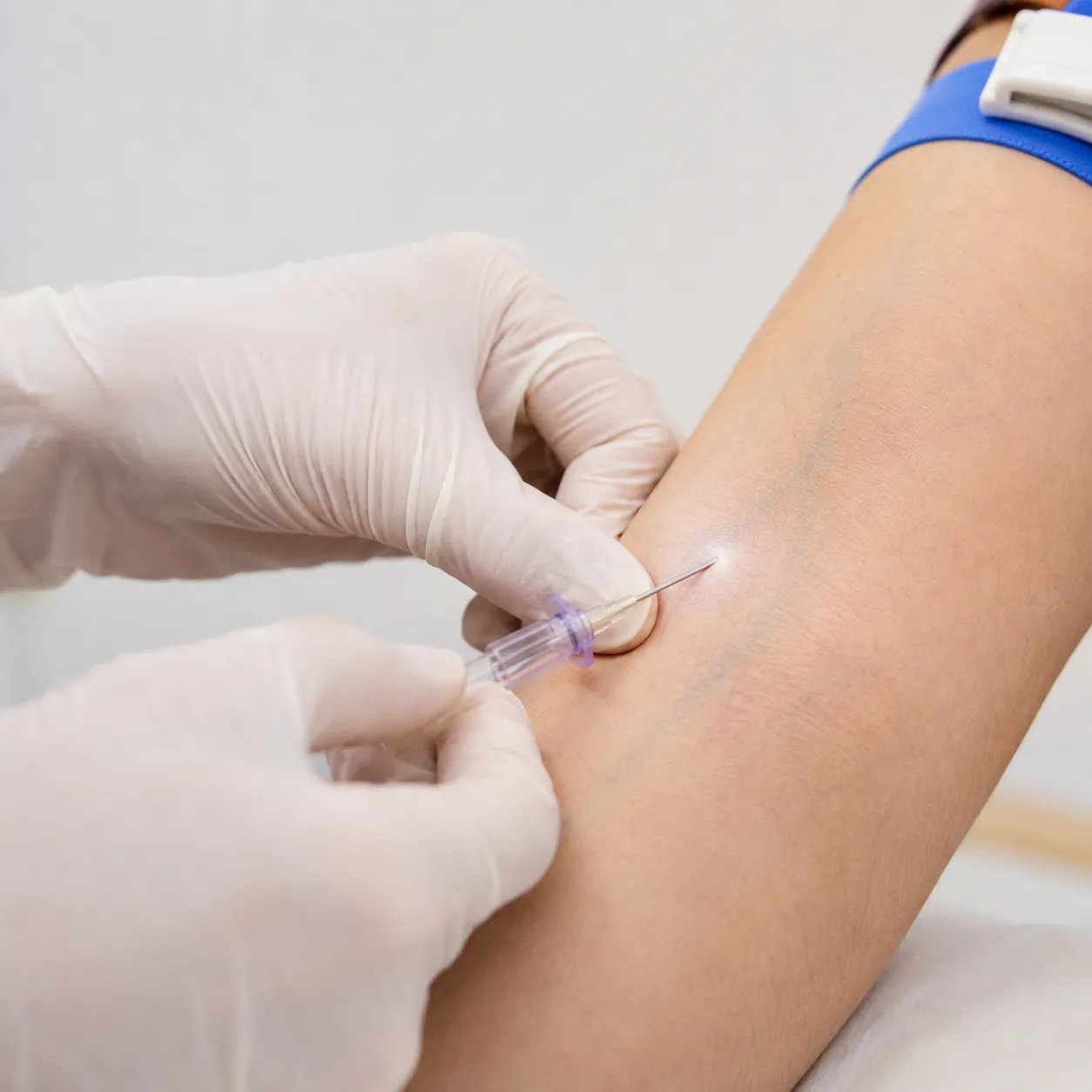 venipuncture