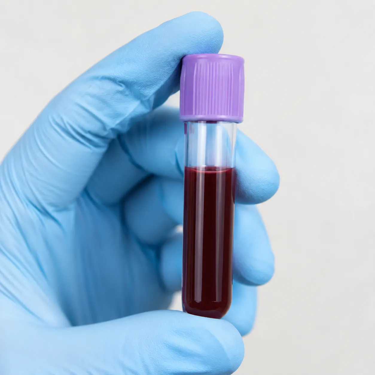 blood sample