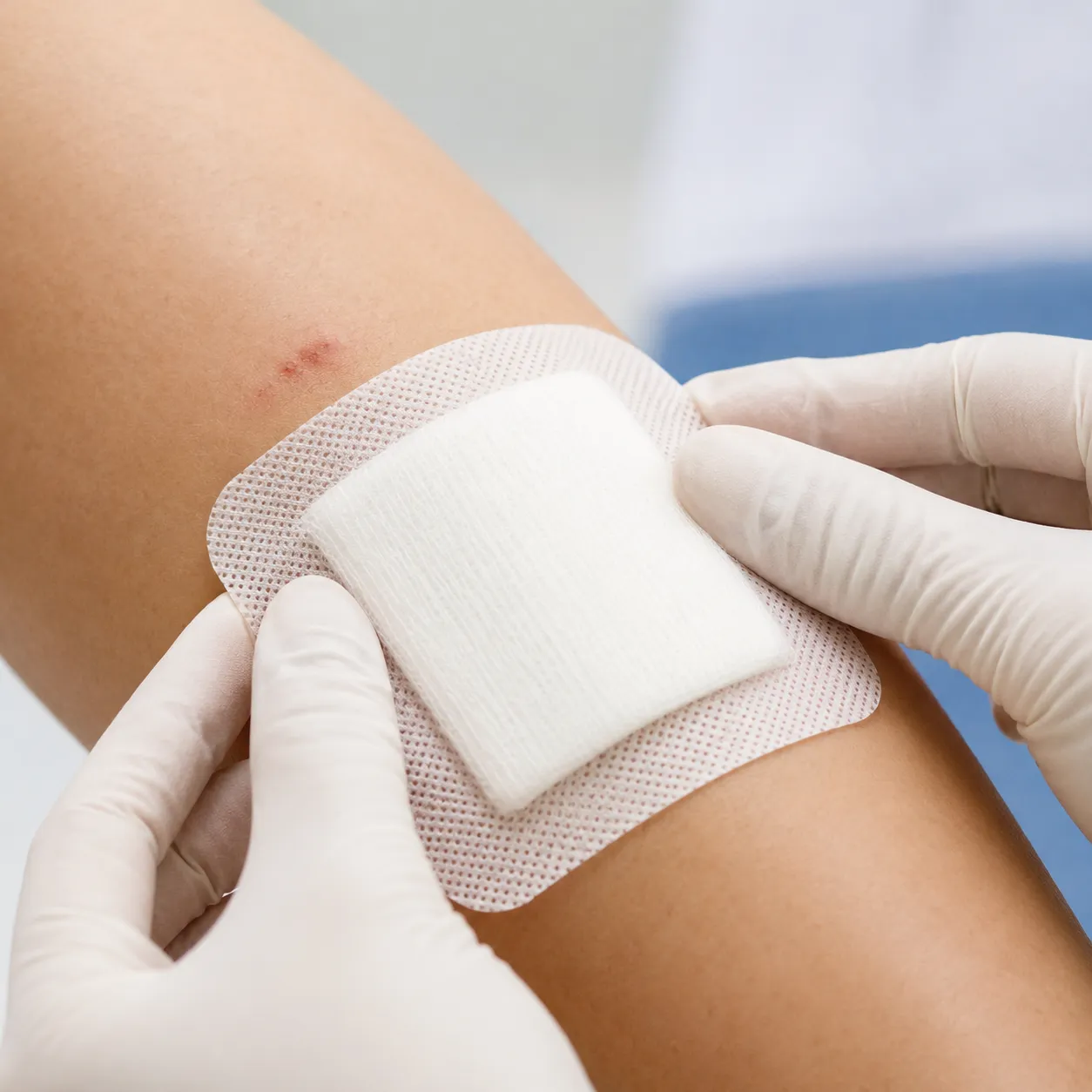 sterile dressing